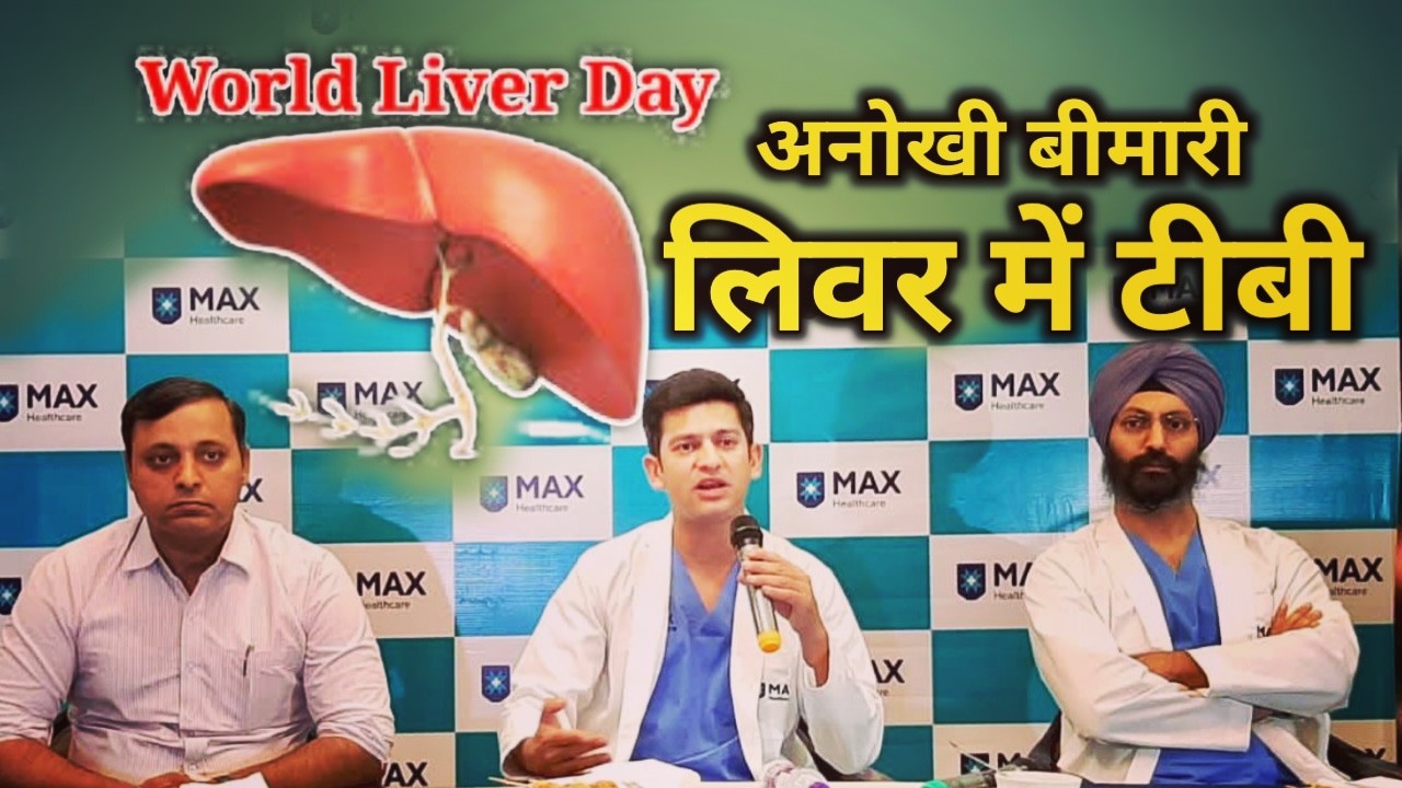 World Liver day : लिवर में प्राइमरी टीबी दुनिया की एक दुर्लभ बीमारी, देहरादून के इस अस्पताल में हुआ इलाज | Max Hospital Dehradun 1 World Liver day Max Hospital